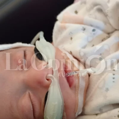 Alma, la trigemela de Santa Cruz fue operada: “Gracias a Dios salió todo bien”