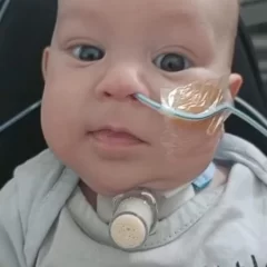 Angelex fue dado de alta, pero necesita recaudar 350 mil pesos para poder salir del hospital y volver a Las Heras