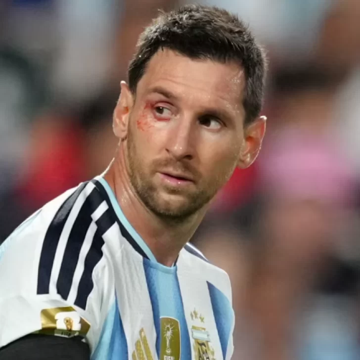 Argentina celebra la clasificación y mira a Messi: cómo se encuentra el capitán Argentina celebra la clasificación y mira a Messi: cómo se encuentra el capitán