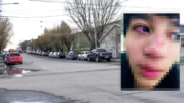 Le dieron una paliza en pleno centro de Río Gallegos, tuvo que ser operado y buscan a los agresores Le dieron una paliza en pleno centro de Río Gallegos, tuvo que ser operado y buscan a los agresores