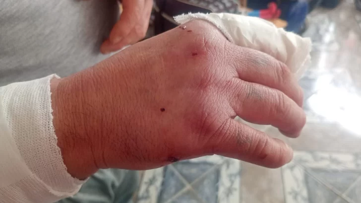 heridas-728x409